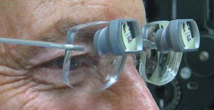 Bioptics-System in einer Brille